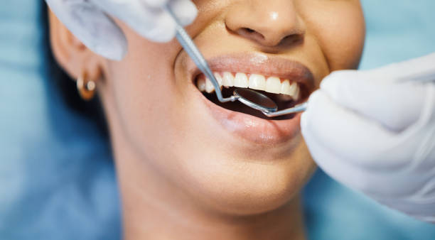 Best Emergency Wisdom Teeth Removal in Claysburg, PA